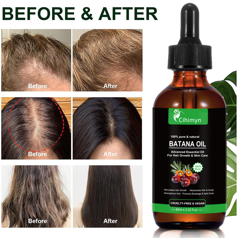 Cihimyn Batana Essential Oil Promotes Hair Growth And Protects Hair