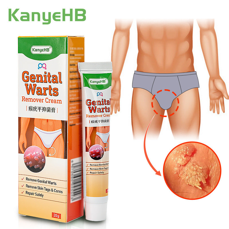 Pinghouyou Wart Remover Cream