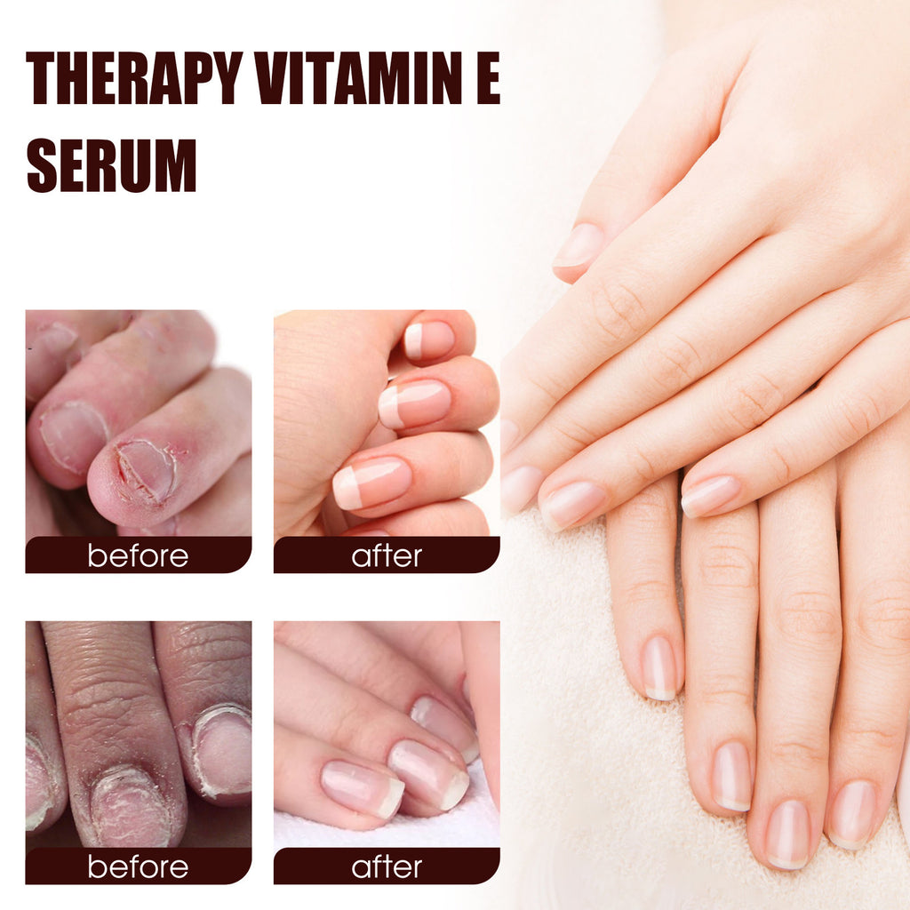 OceAura Household Hand And Foot Cutin Nail Essence