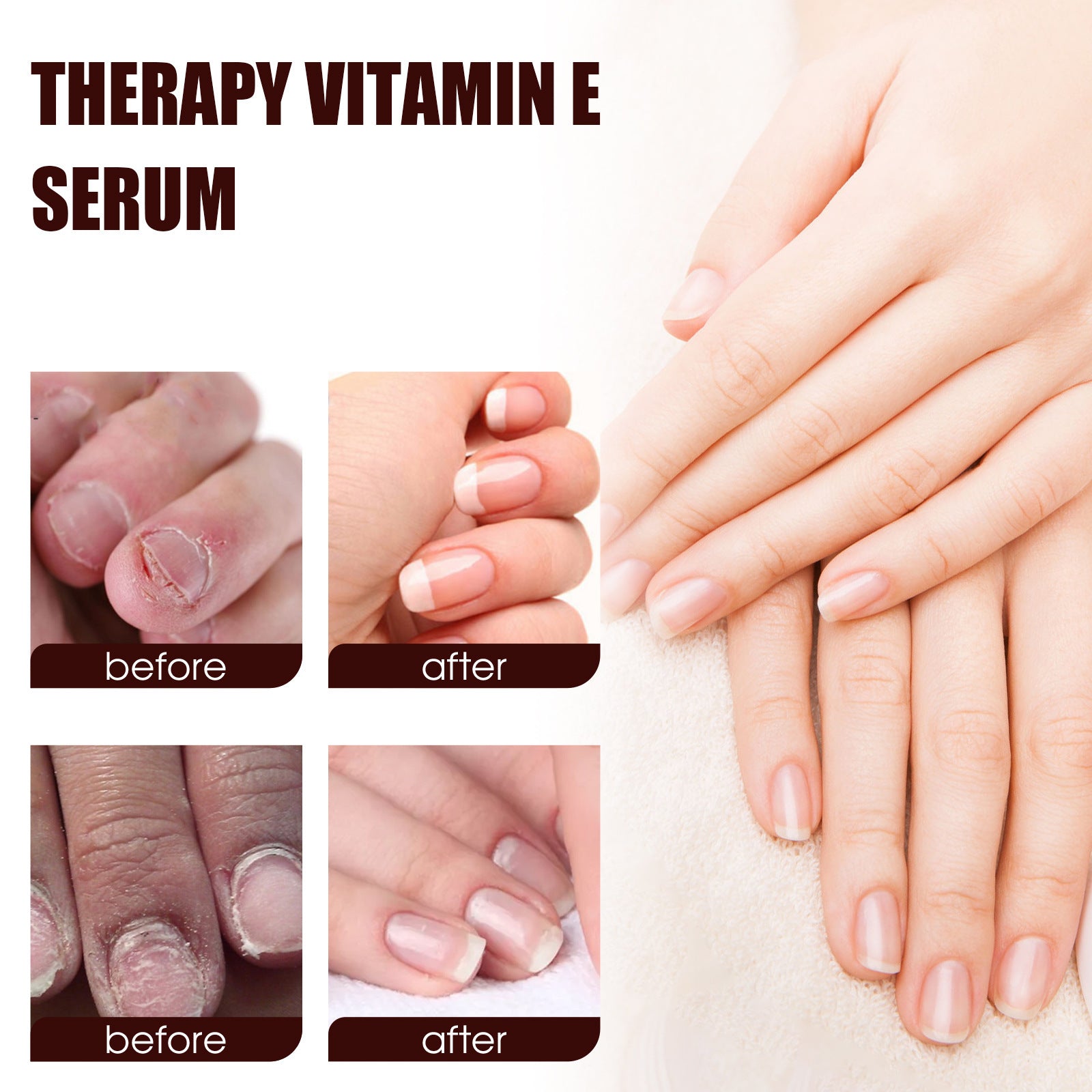 OceAura Household Hand And Foot Cutin Nail Essence