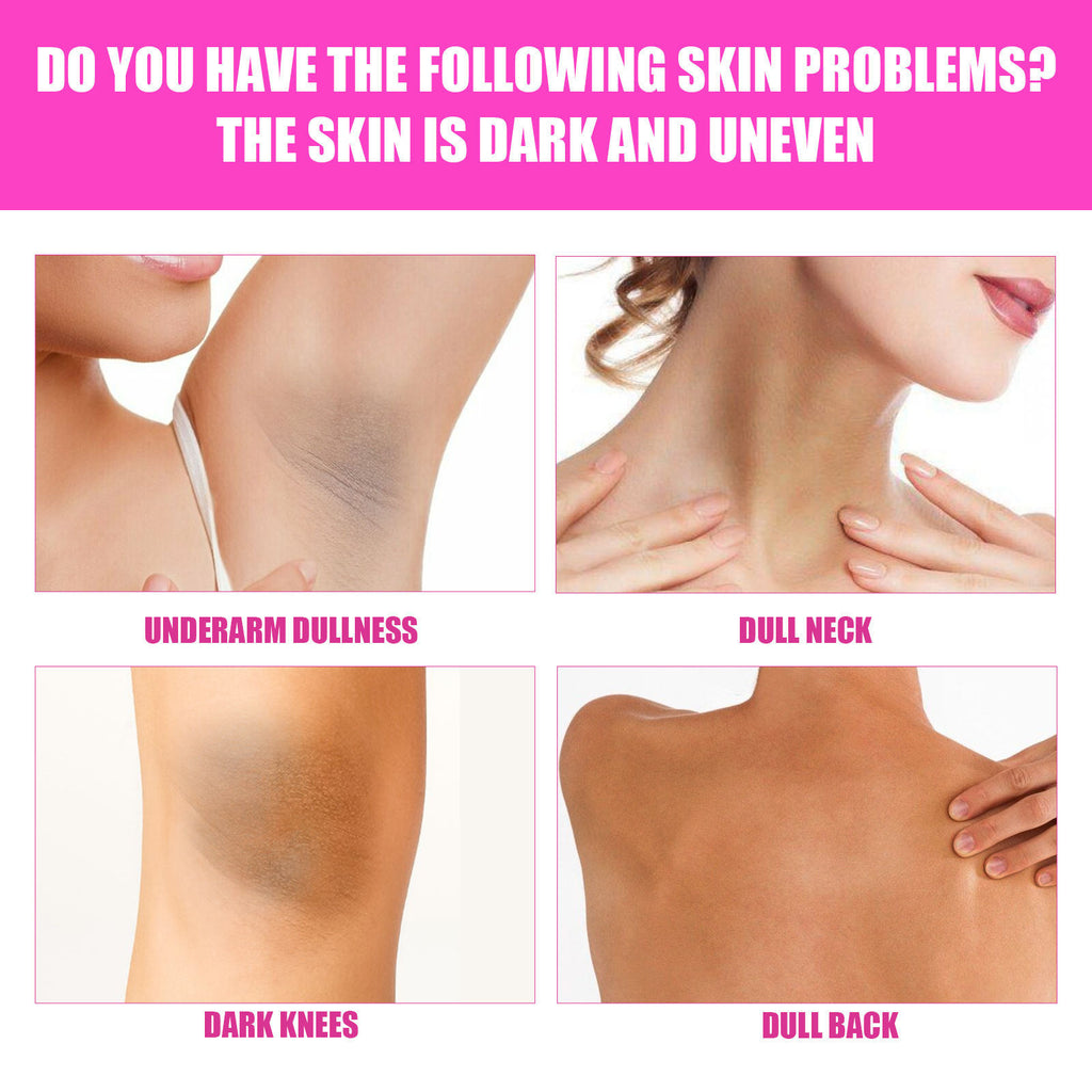 Elbow Private Part Skin Beauty Underarm Whitening Cream