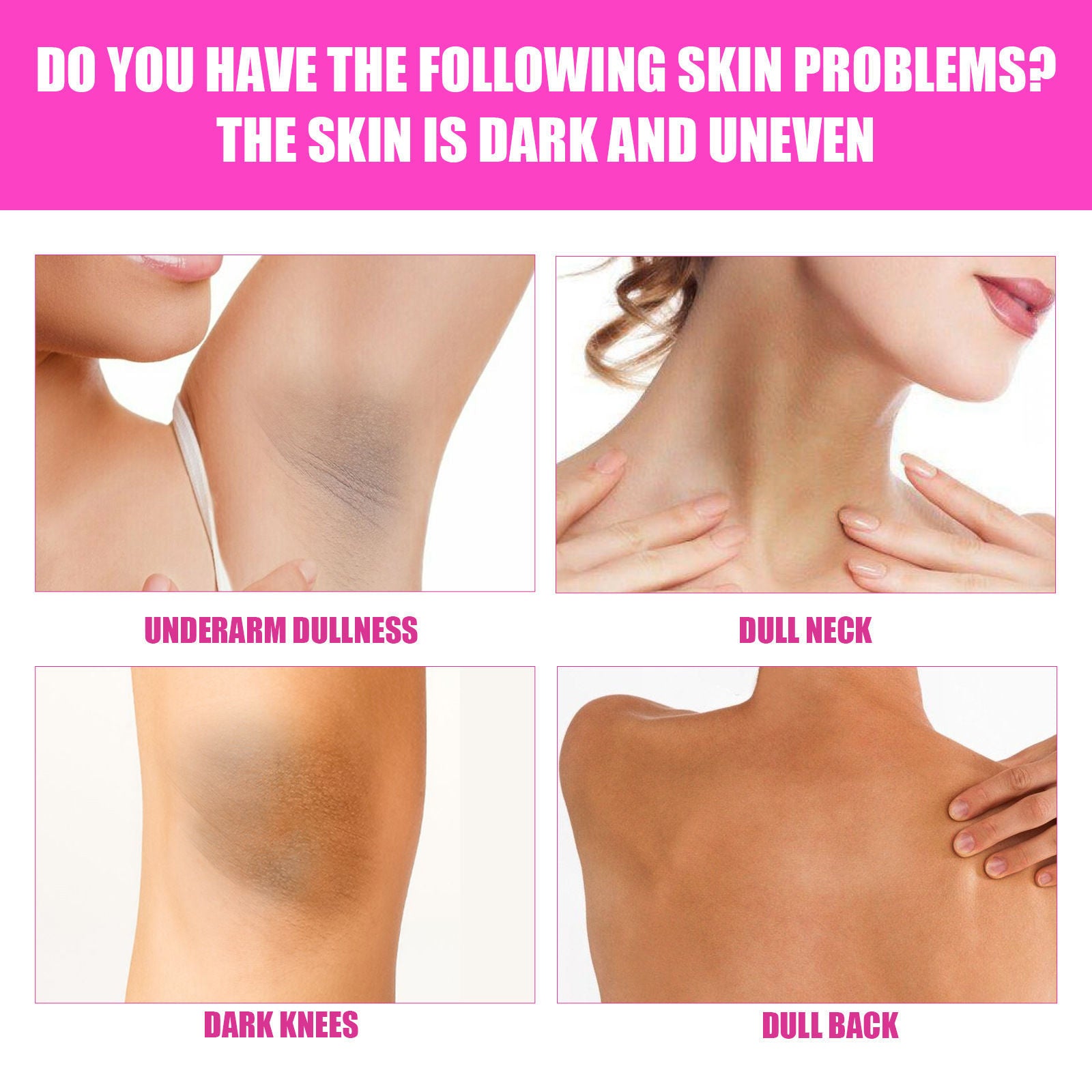 Elbow Private Part Skin Beauty Underarm Whitening Cream