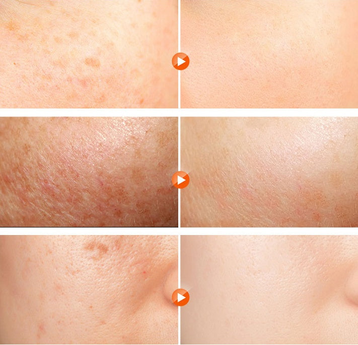 RÃƒâ€šÃ‚Â·RASHEL Whitening Night Cream