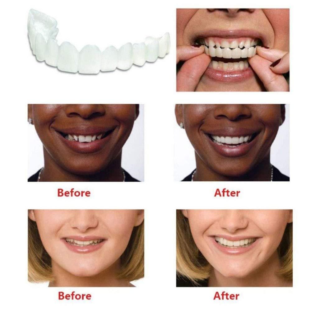 Teeth Denture (Pack Of 3)