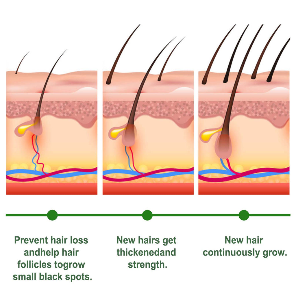 Eelhoe Rosemary Hair Care Capsules Nourish Hair Roots And Prevent Hair Loss