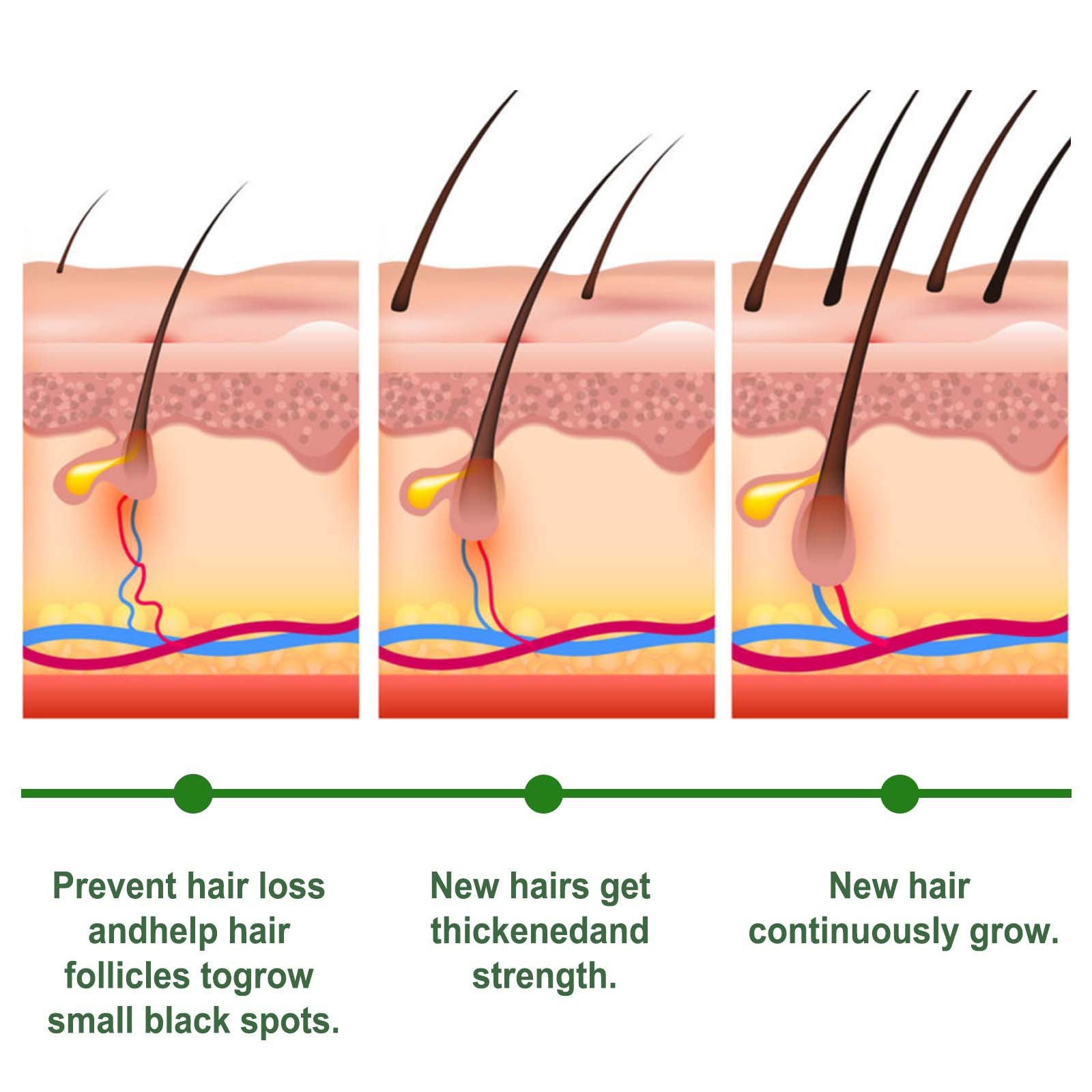 Eelhoe Rosemary Hair Care Capsules Nourish Hair Roots And Prevent Hair Loss