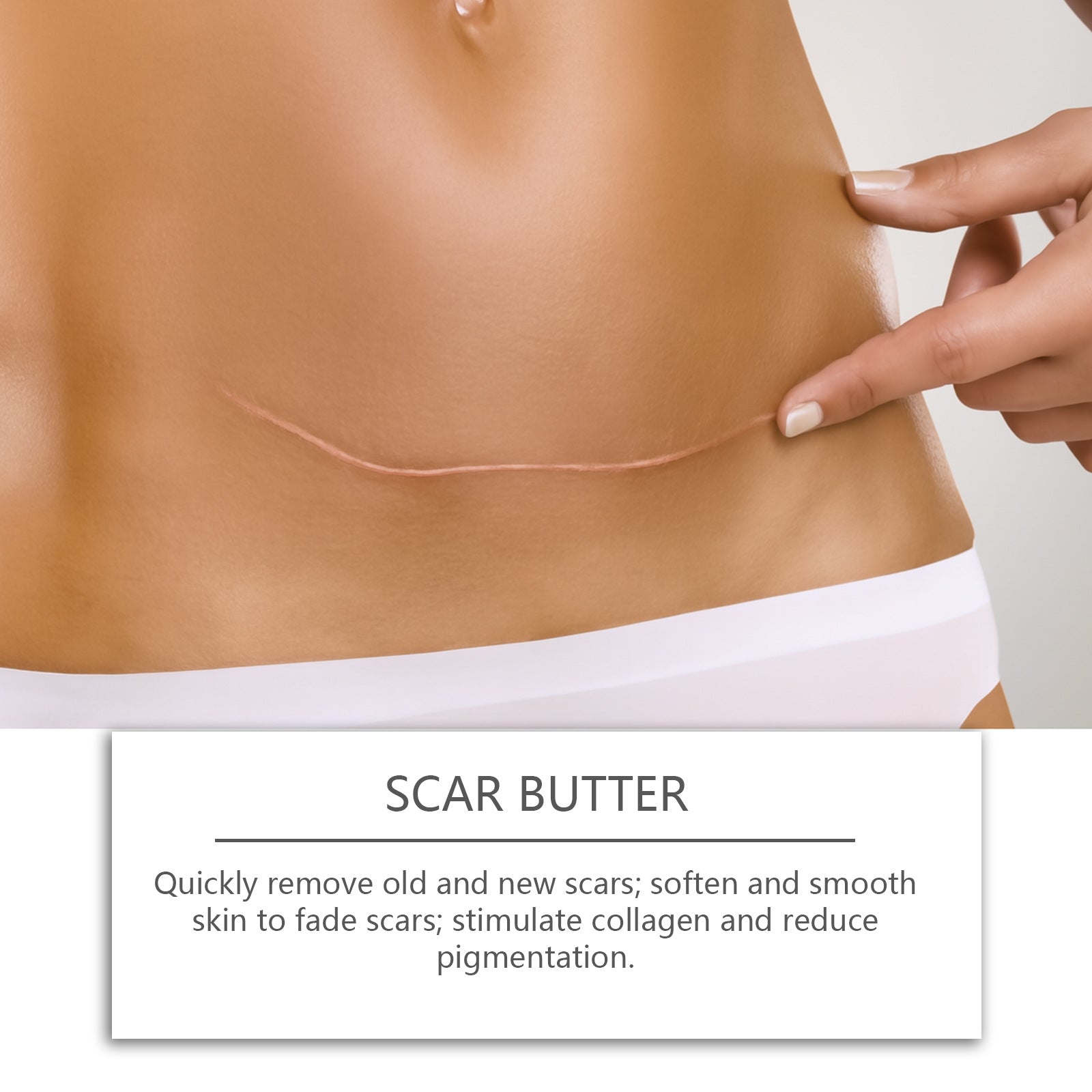 Scar Repair Cream