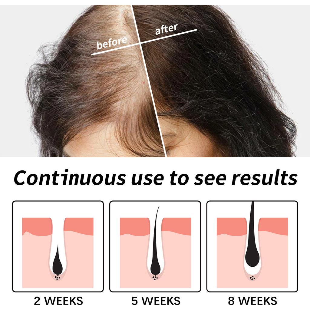 Eelhoe Hair Dense Hair Moisturizing And Repairing Dry Hair