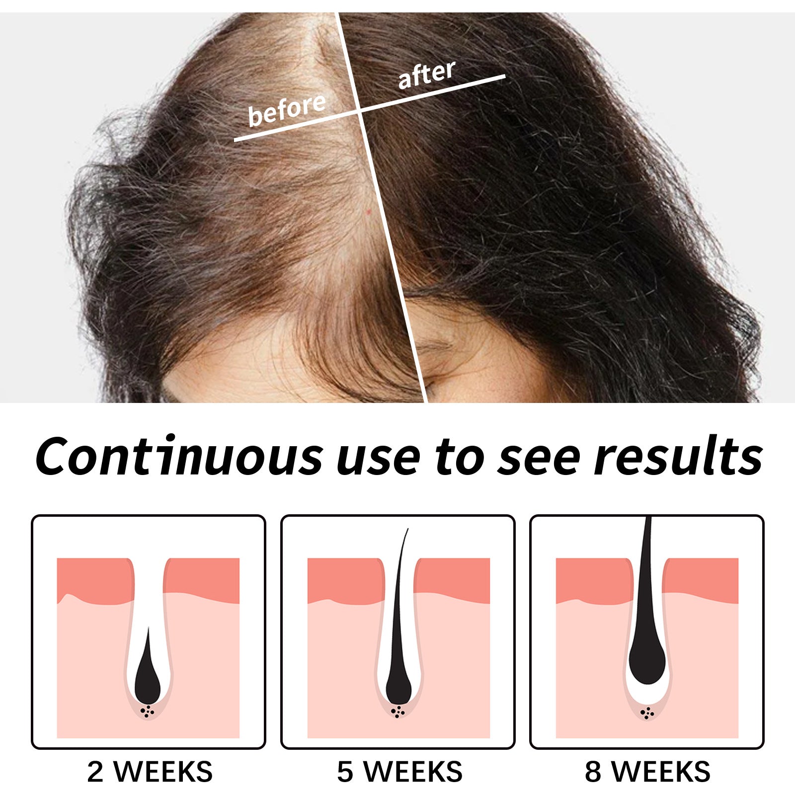 Eelhoe Hair Dense Hair Moisturizing And Repairing Dry Hair