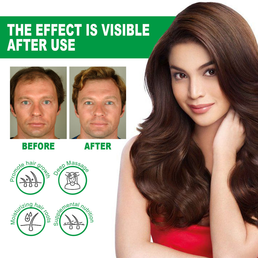 Eelhoe Nourishing Anti-hair Loss Thick Hair Care