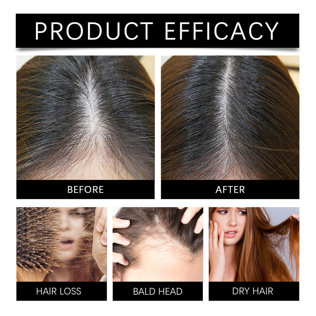 Ouhoe Marjoran Mi Hair Oil Moisture Replenishment Hair Essence For Repairing Dry And Manic Hair