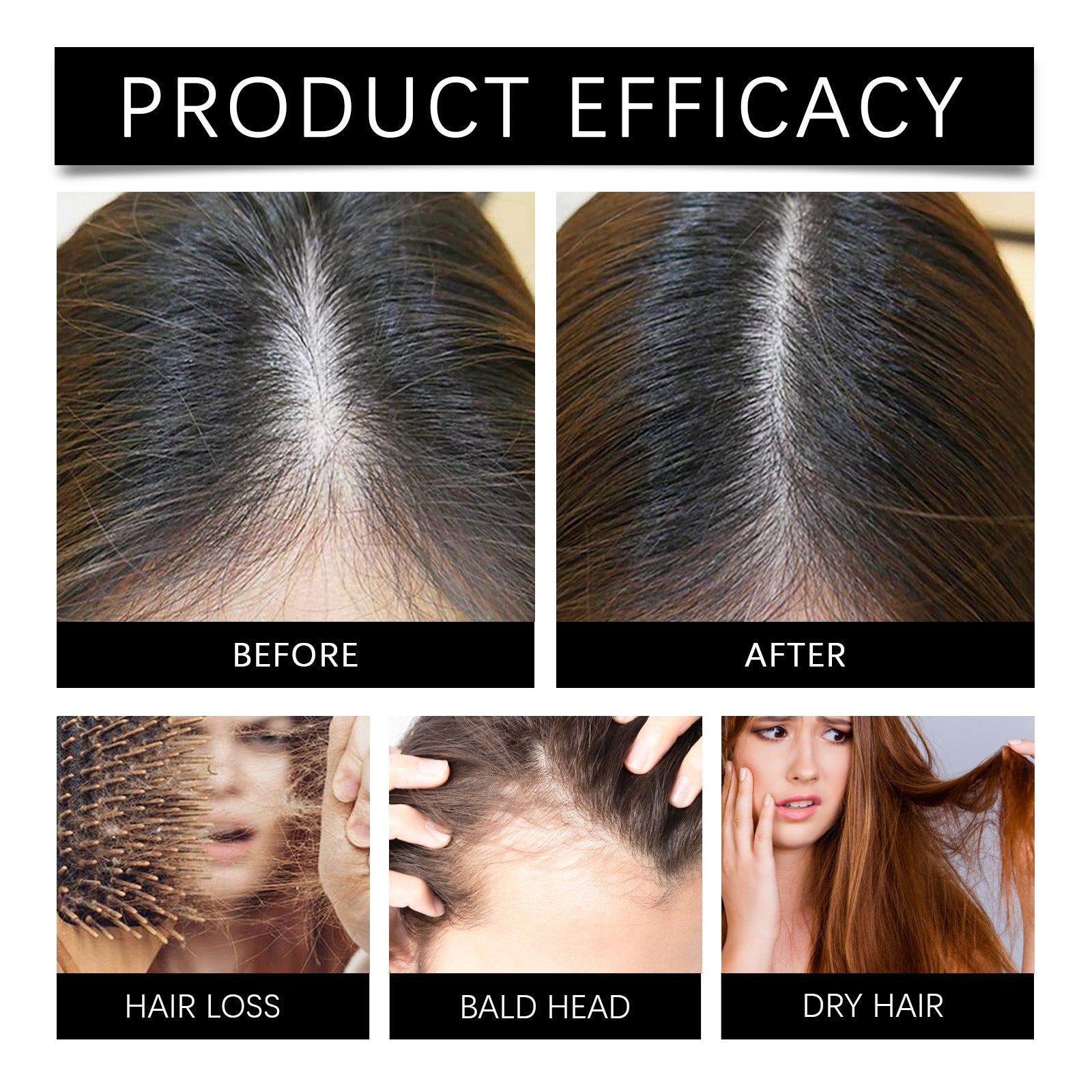 Ouhoe Marjoran Mi Hair Oil Moisture Replenishment Hair Essence For Repairing Dry And Manic Hair