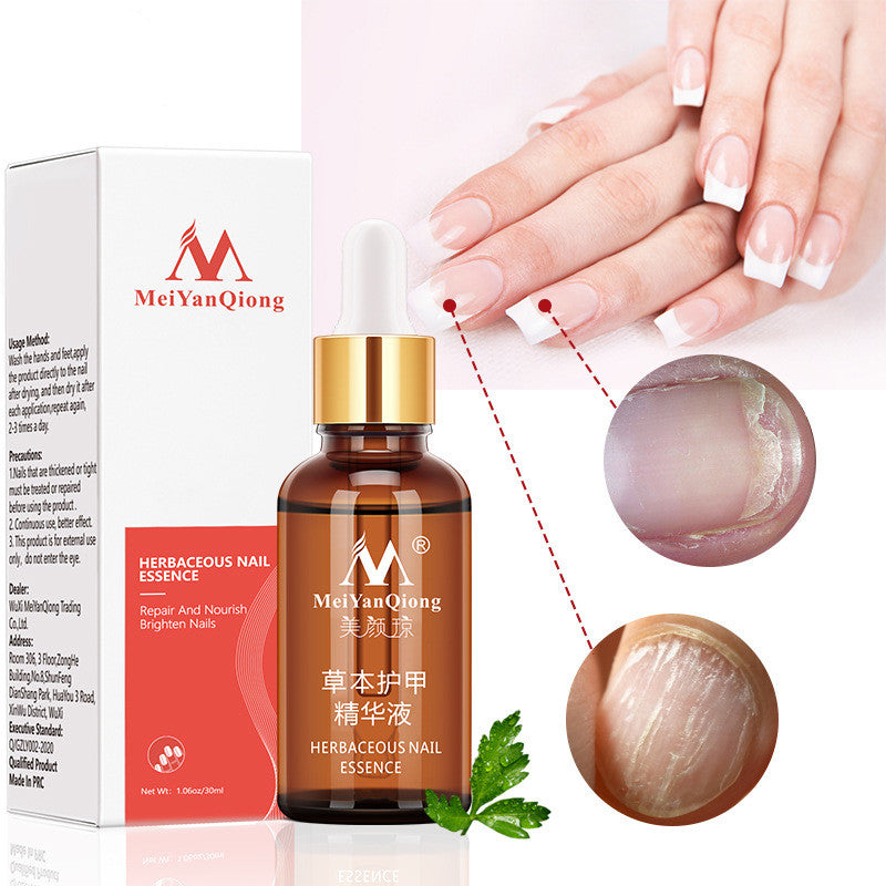 MieYanQiong Beauty Joan Herbal Vitality Nail Nail