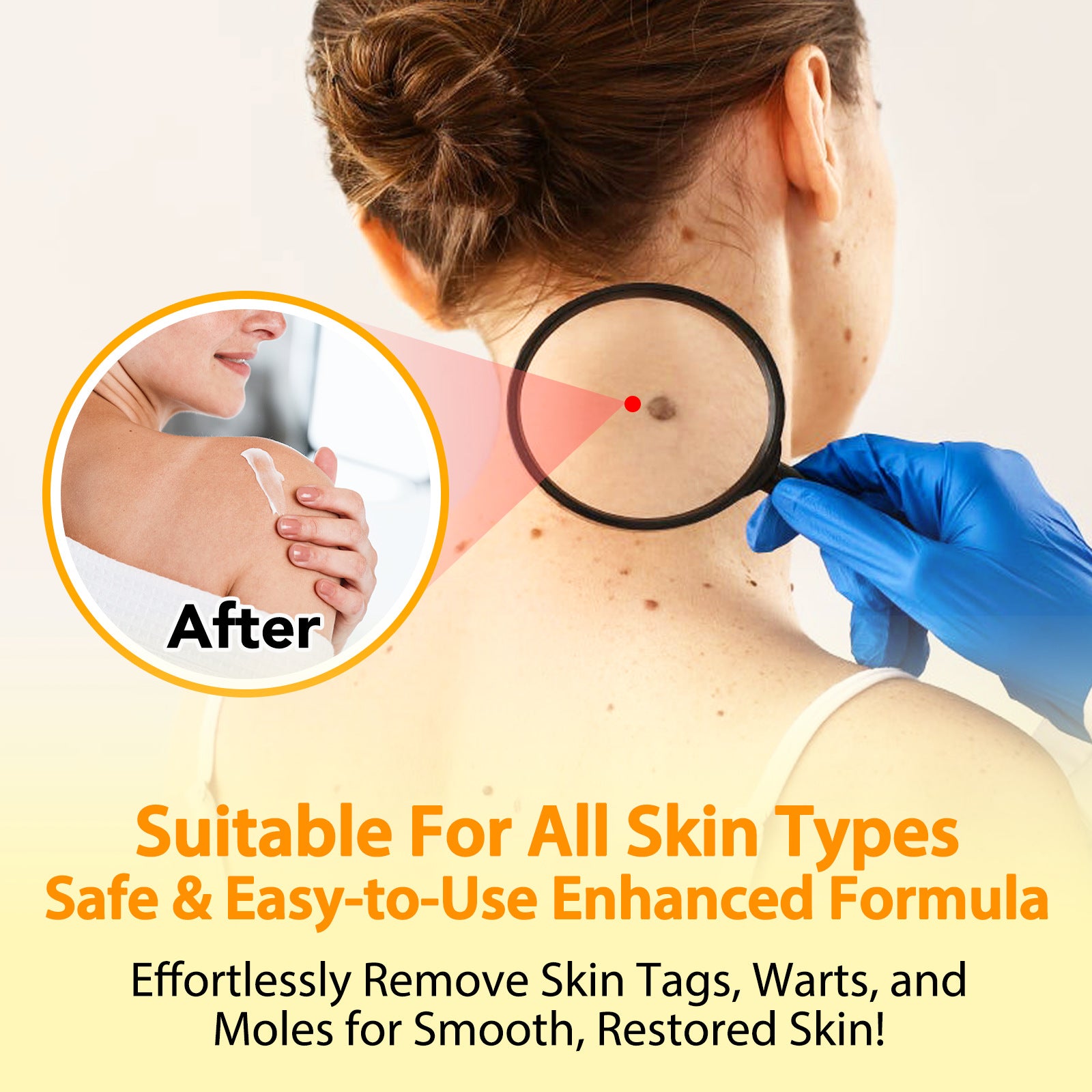 Exfoliating Smooth Skin Moles Wart Cream