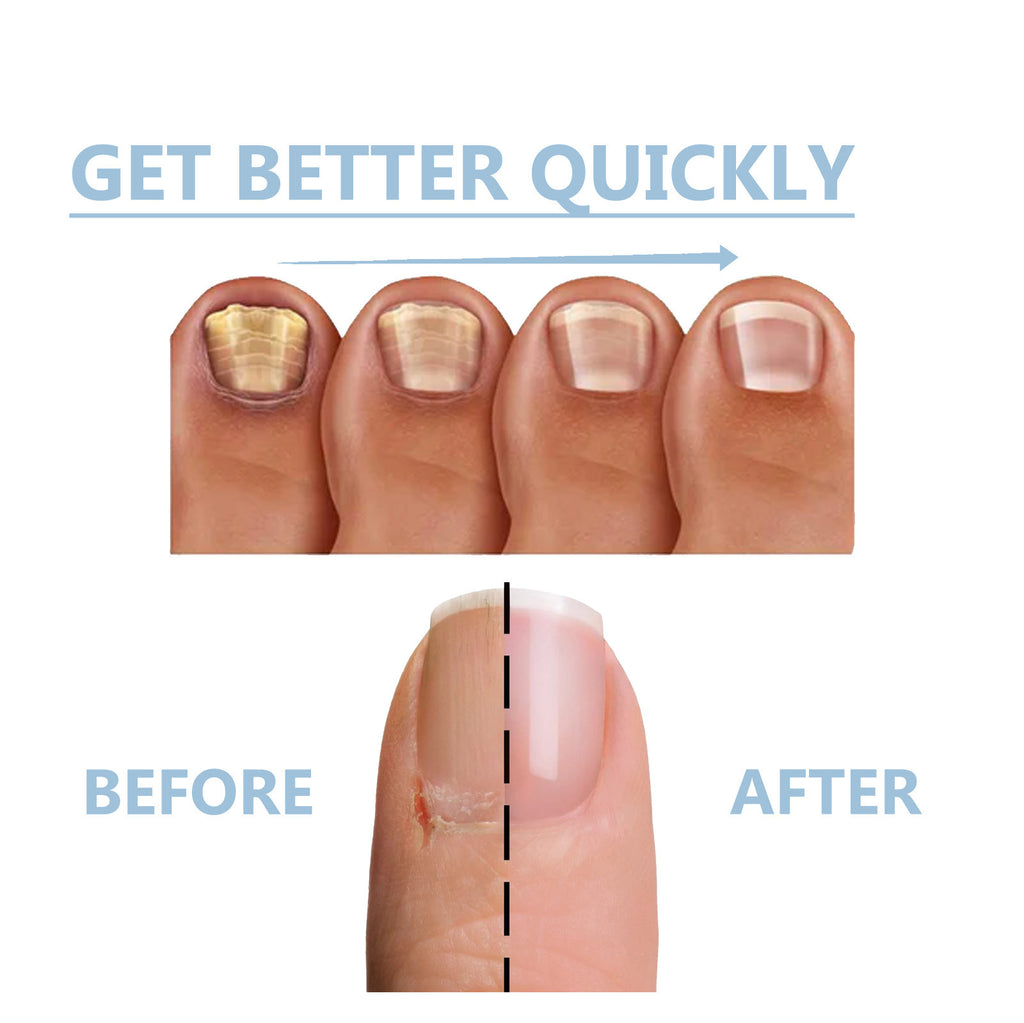 Oceaura Hand And Foot Nail Nutrition Moisturizing Repair Soft Nail Gentle Cleaning Bright Nail Care