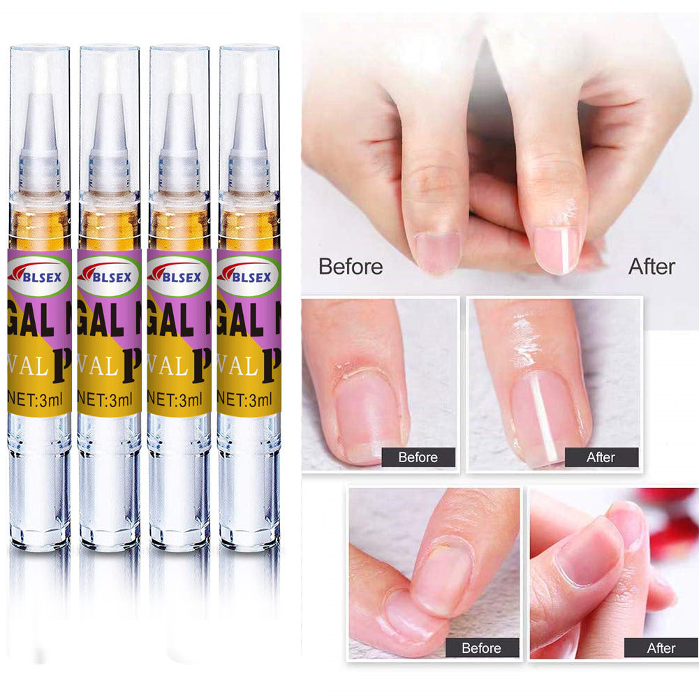 BLSEX Nail Treatment Fluid Nail Fungus Treatment
