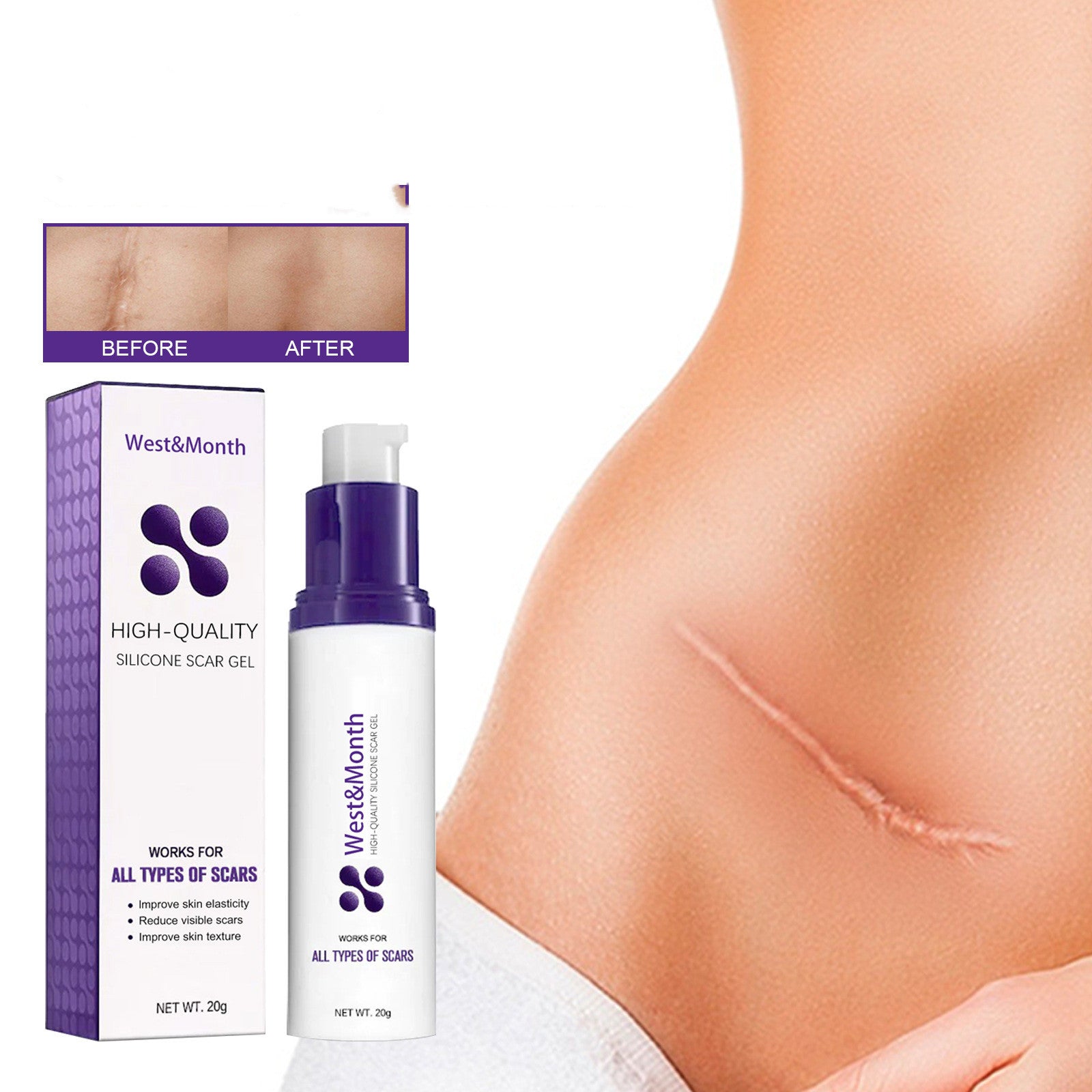 Scar Repair Cream Smallpox Diluting