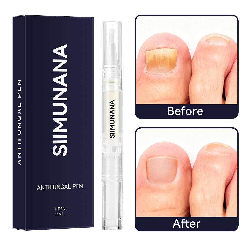 Simunana Hand And Foot Nail Thickening Bright Nail Gray Nail Antibacterial Care Solution