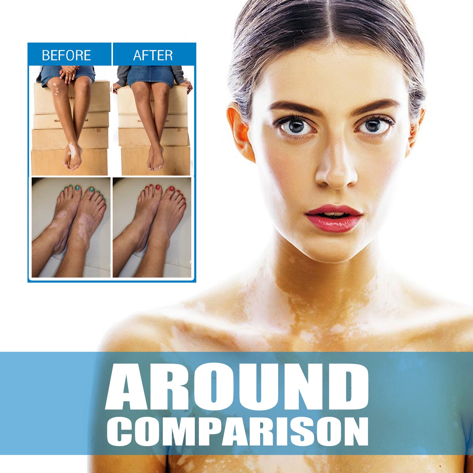 Nursing Efficacy On Skin Cream