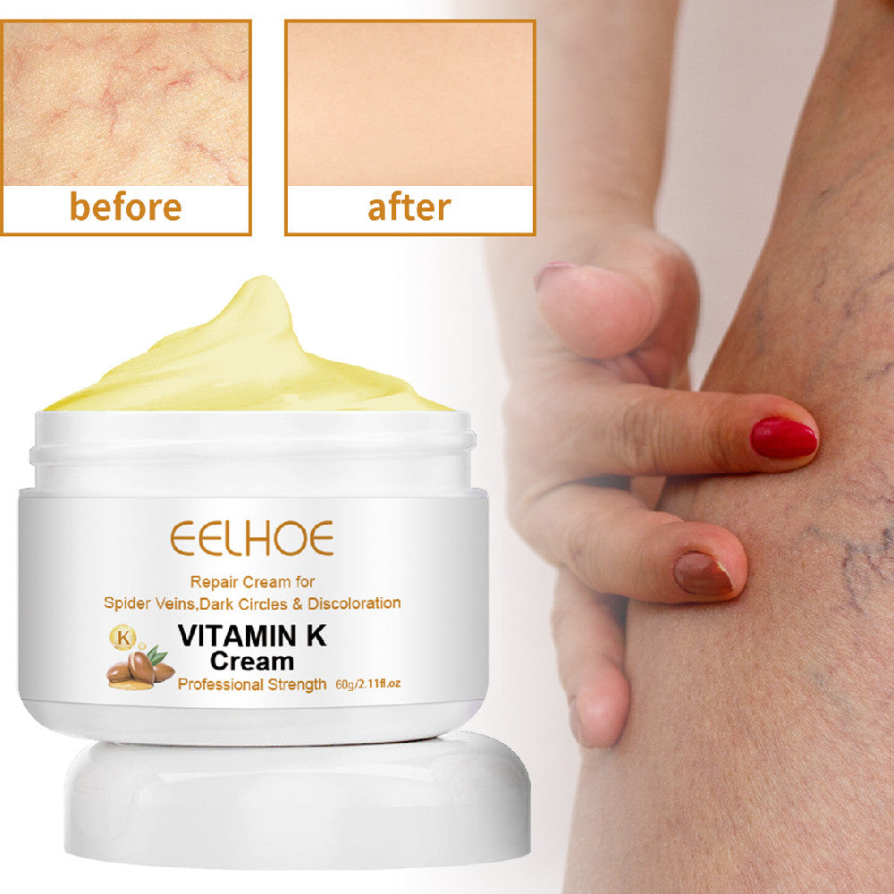 Bulge And Swelling Of Legs Repair Cream