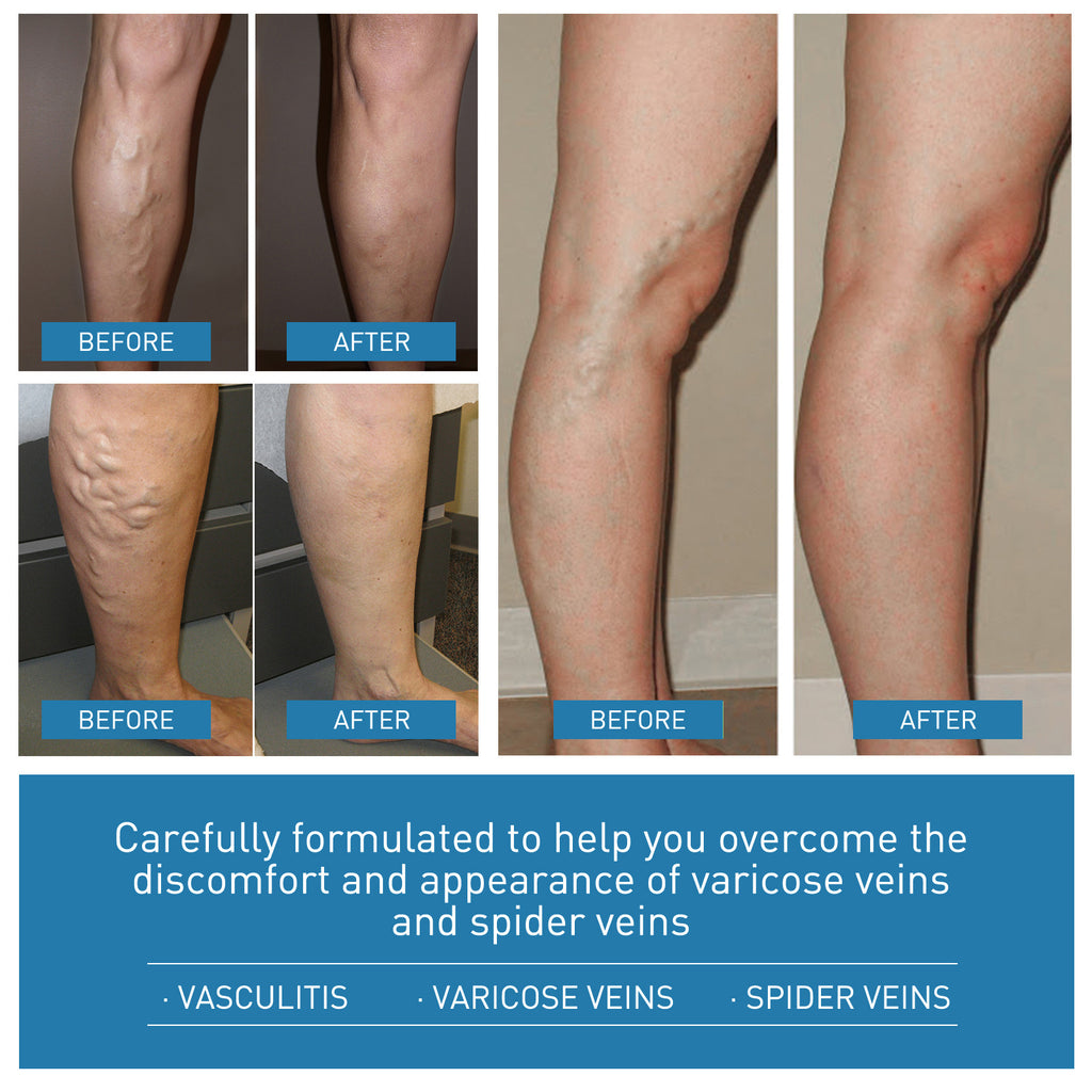 Intravenous Repair Cream Relieve Leg Pain Leg Massage Soreness Maikang Neck Cream