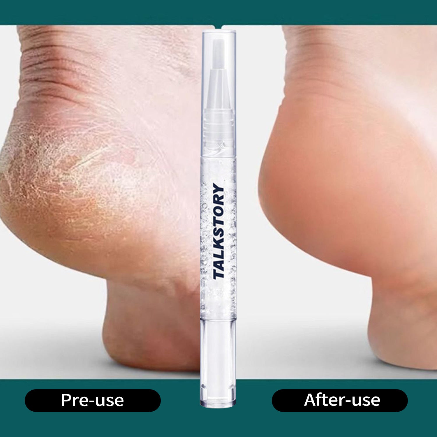 TalkStory Nail Nutrition Oil Pen Exfoliating Skin Anti-agnail Manicure Implement