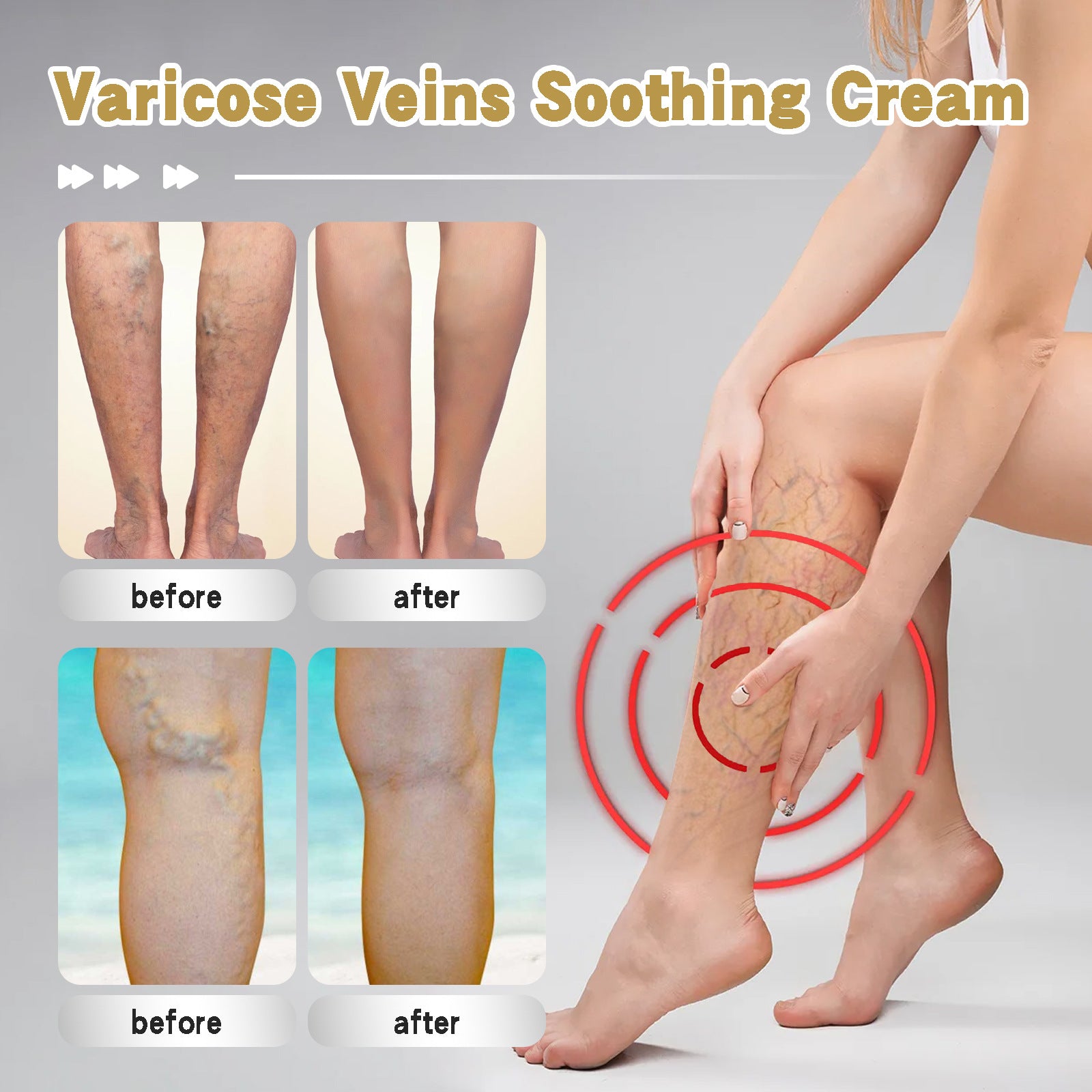 Vein Repair Cream Relieve Leg Bulge