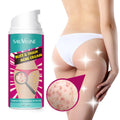 Hip And Leg Acne Cream Moisturizing
