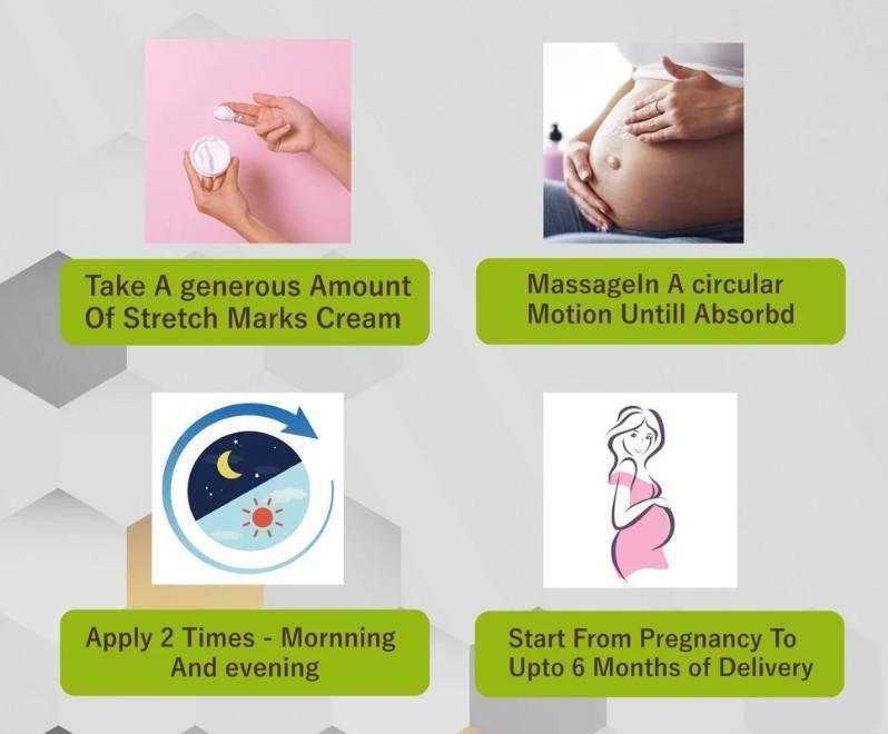 Stretch Mark Removal Cream 50gm Each Pack of 2