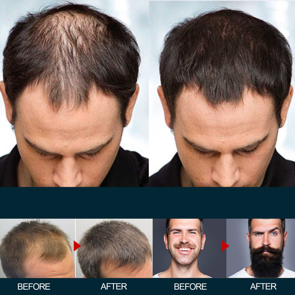 East Moon Men's Hair Nutrition Care Anti-hair Fixing Thick Moisturizing