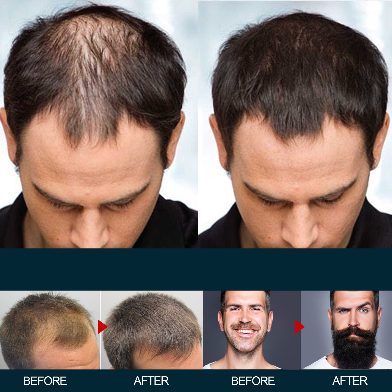East Moon Men's Hair Nutrition Care Anti-hair Fixing Thick Moisturizing