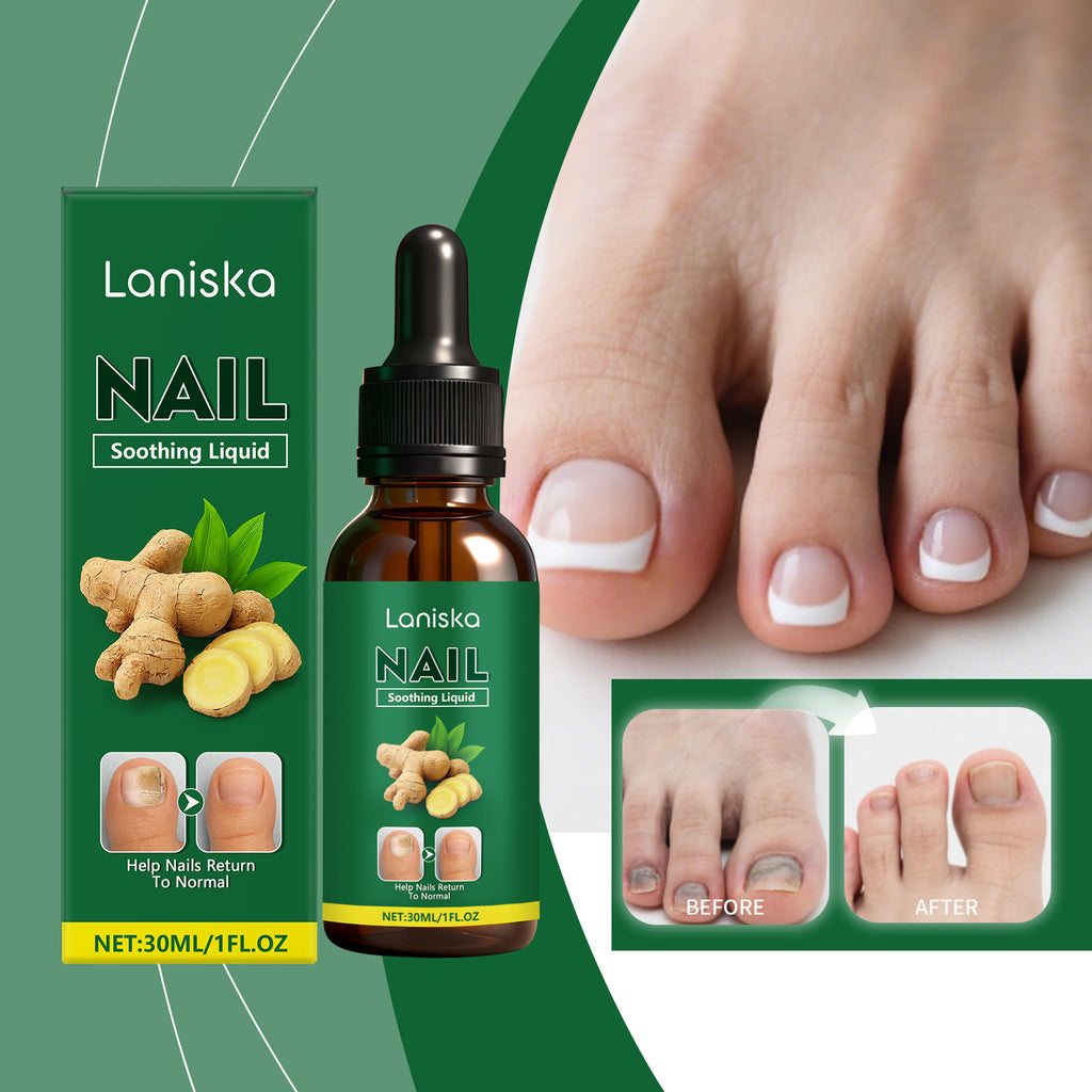 Ginger Nail Care Solution