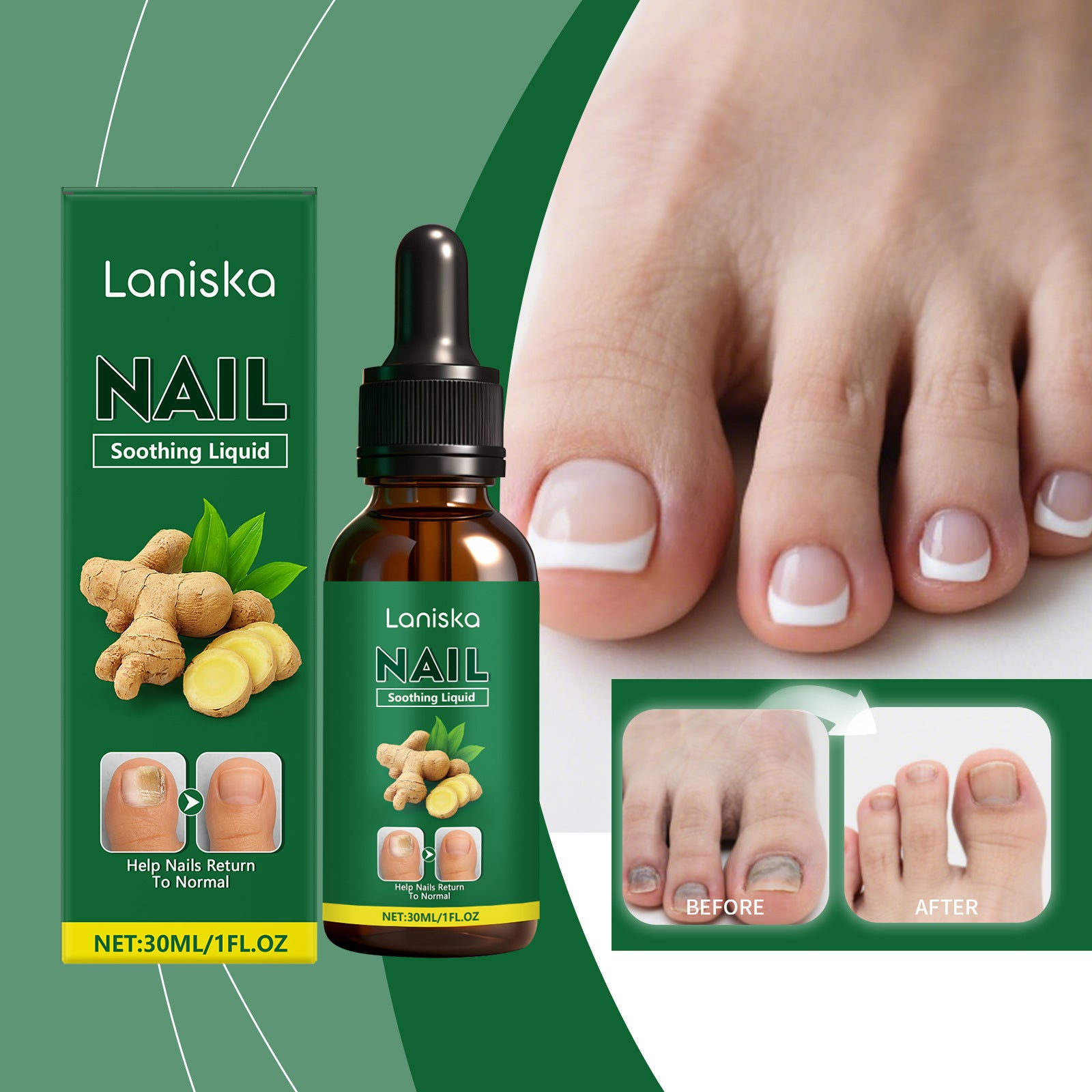 Ginger Nail Care Solution