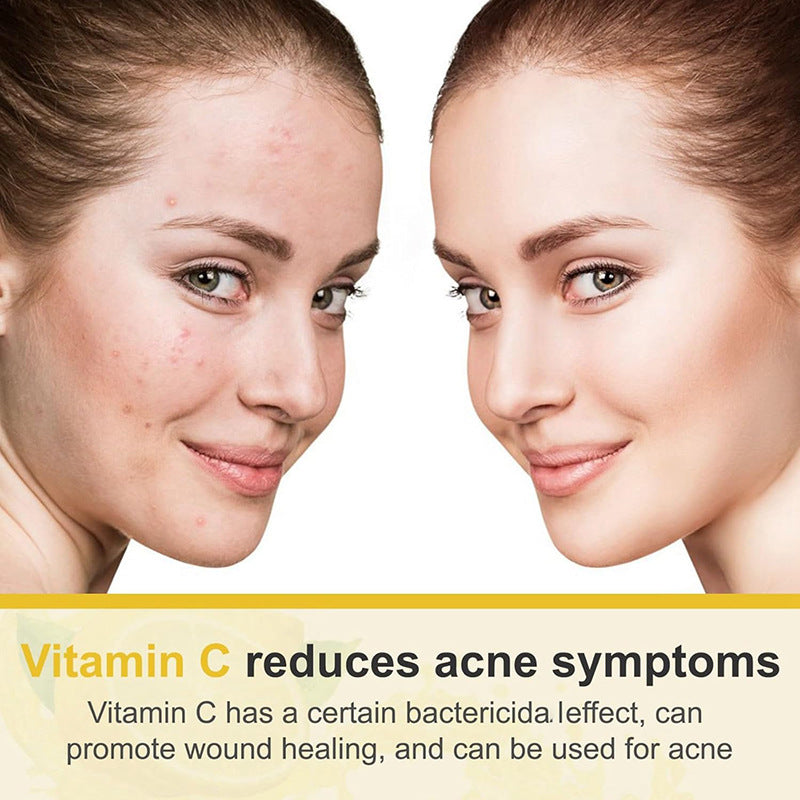 Moisturizing Nicotinamide Smooth Skin Cream