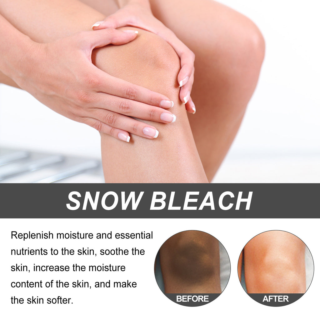 Anti-Darkening Cream Whitening Cream For Underarms And Thighs, Joint Skin Care Cream