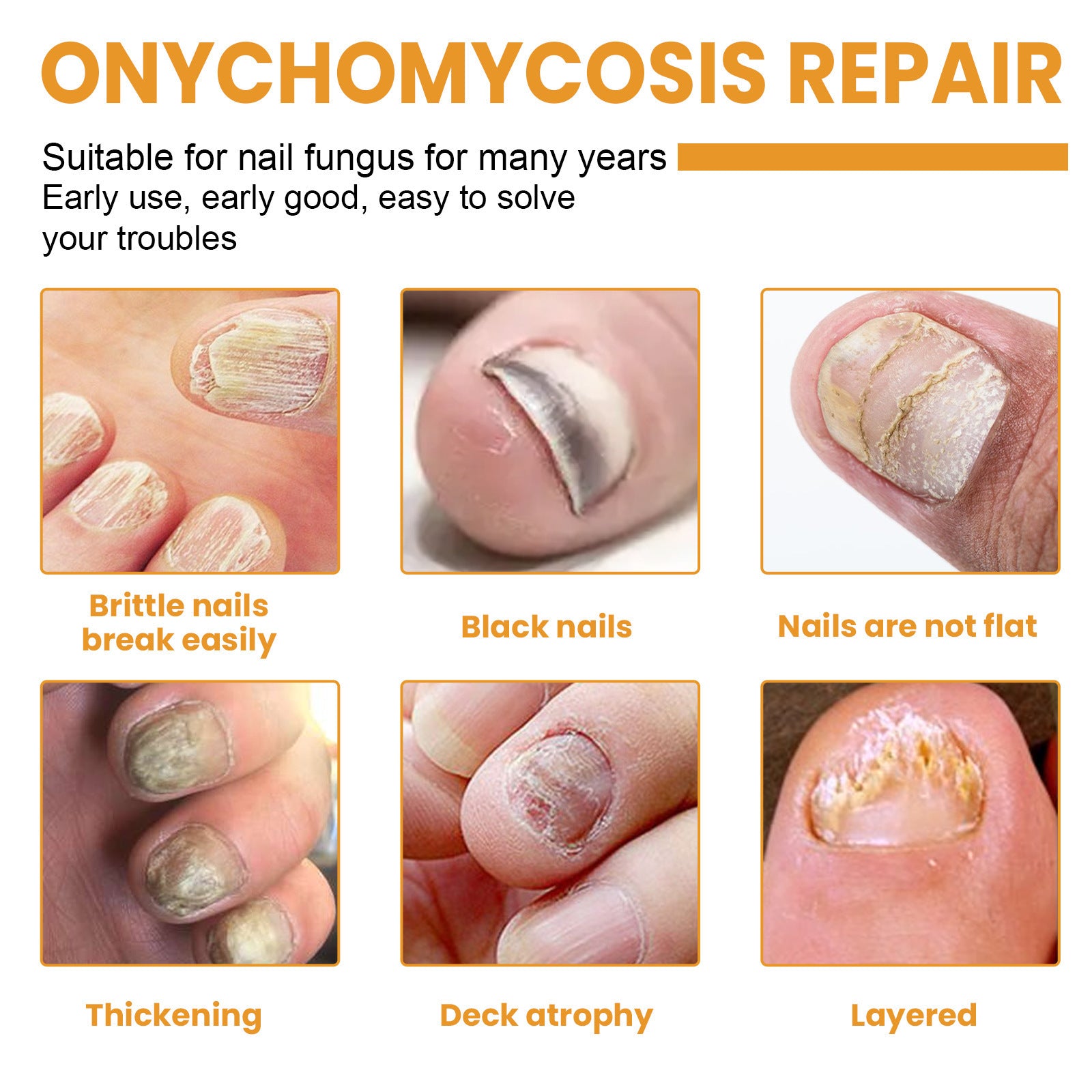Ximonth Nail Repair Patch Repair Ingrown Nail