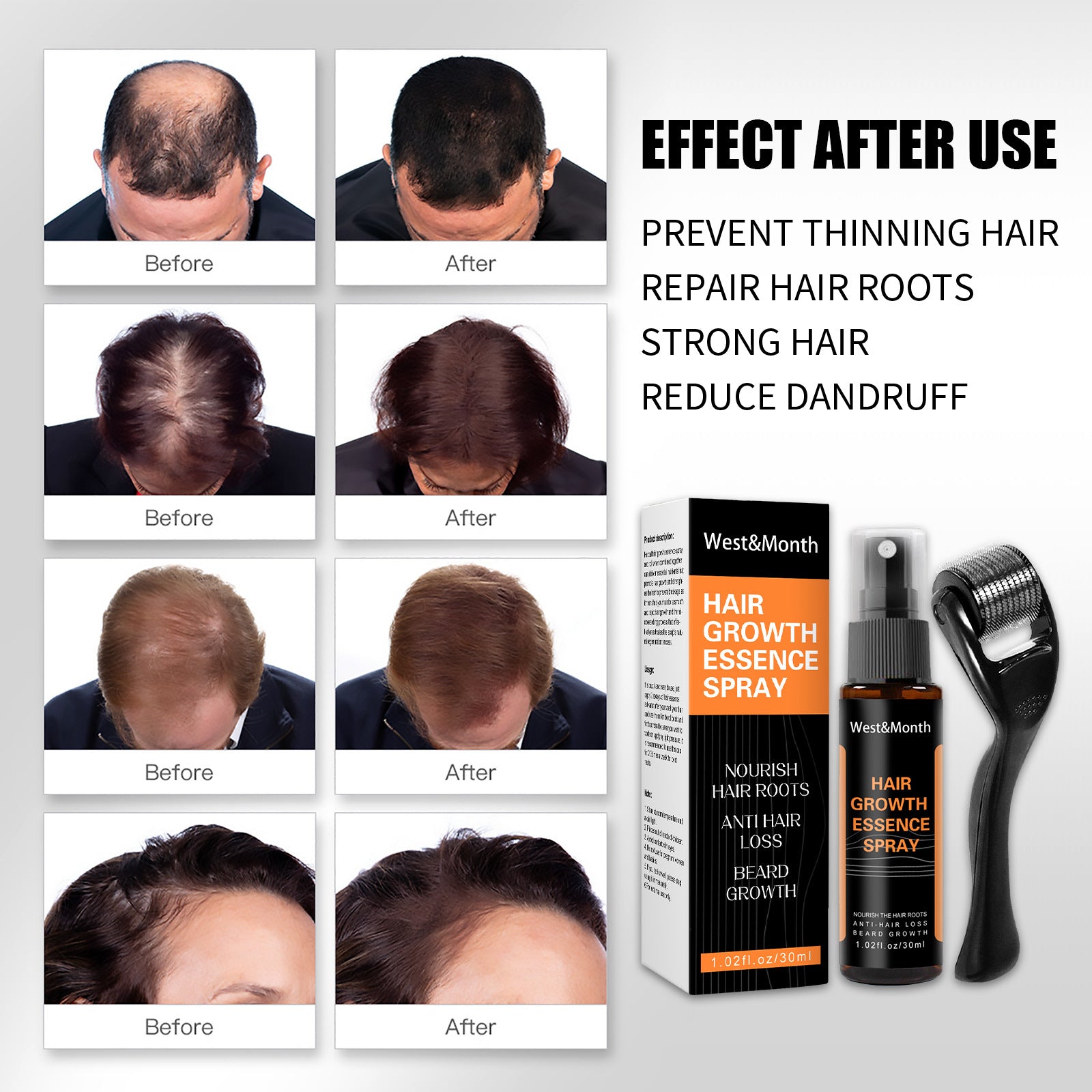 West&Month Hair Growth Spray Anti-hair Nourishing Growth Liquid