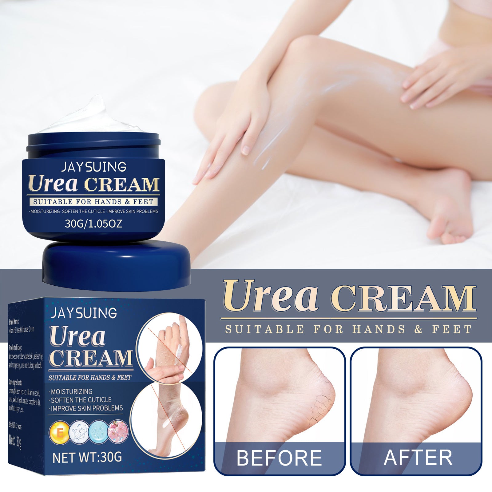 Cracked Hands And Feet Urea Cream Hydrating