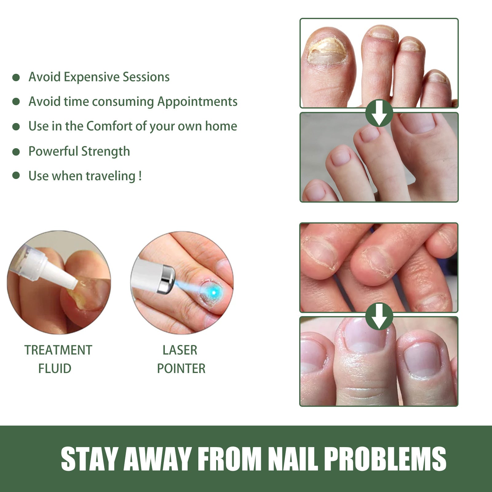 South Moon Nail Cleaning And Nail Repair Suit
