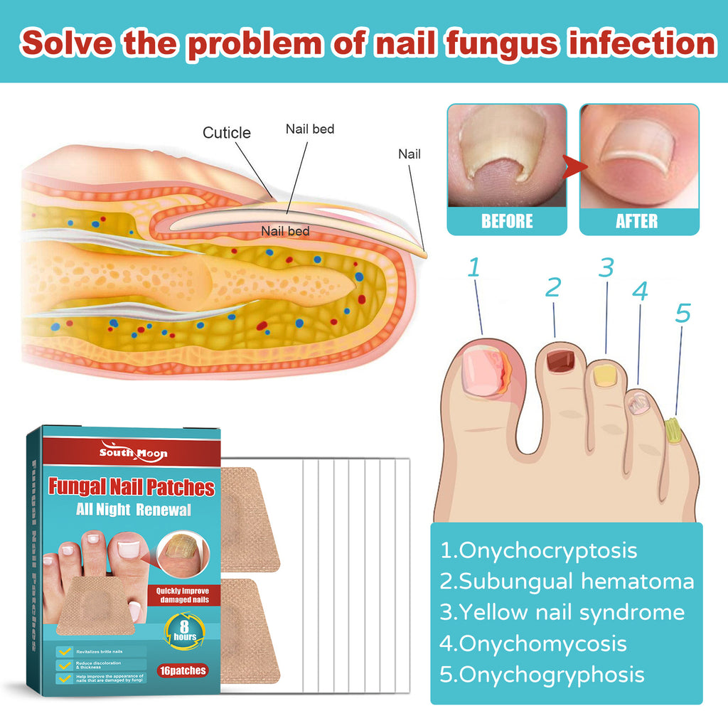 South Moon Nail Care Night Patch Soft Nail Thickening