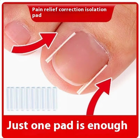 Special Nail Embedding Device For Correcting Paronychia