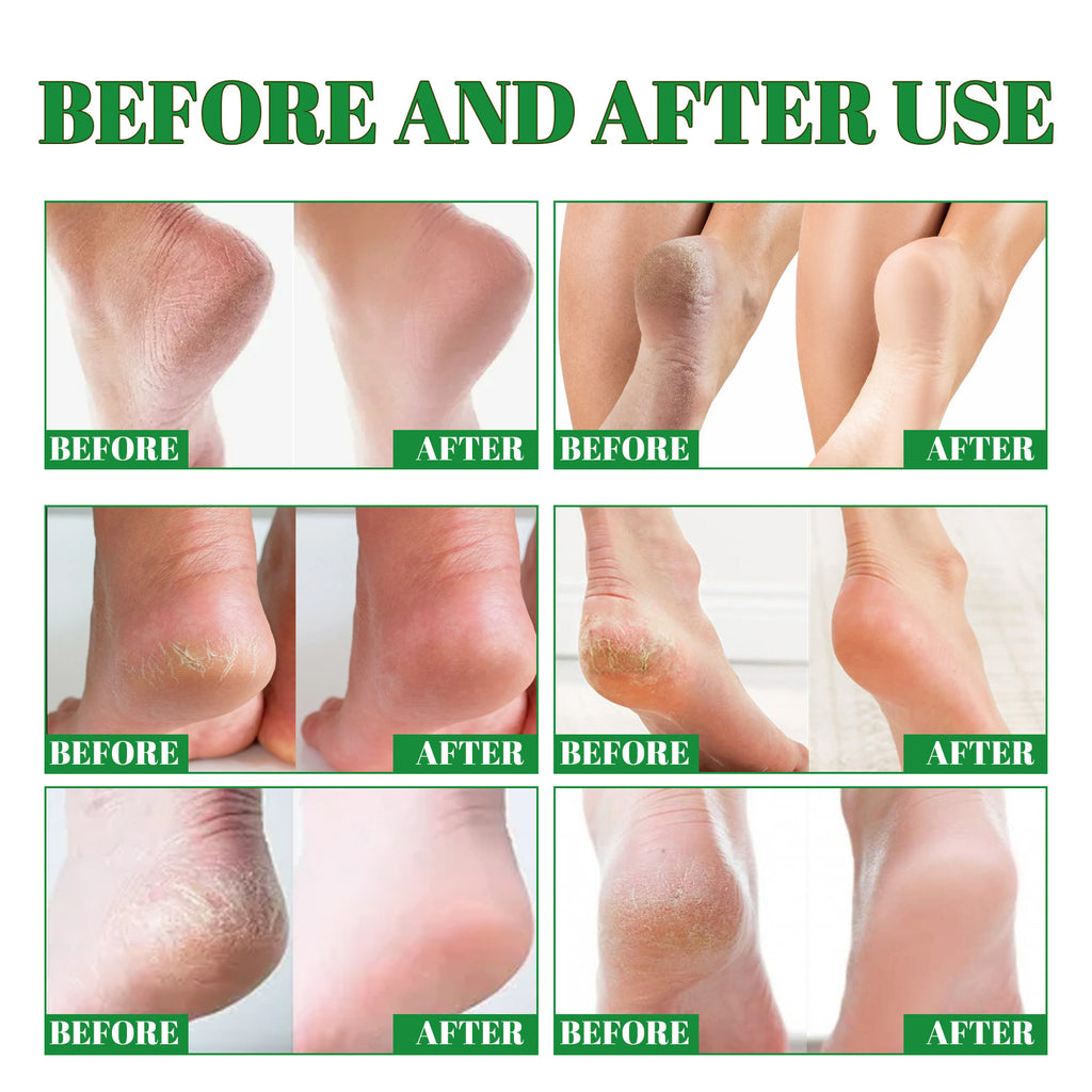 Deep Cleansing Foot Heel Moisturizing Cream