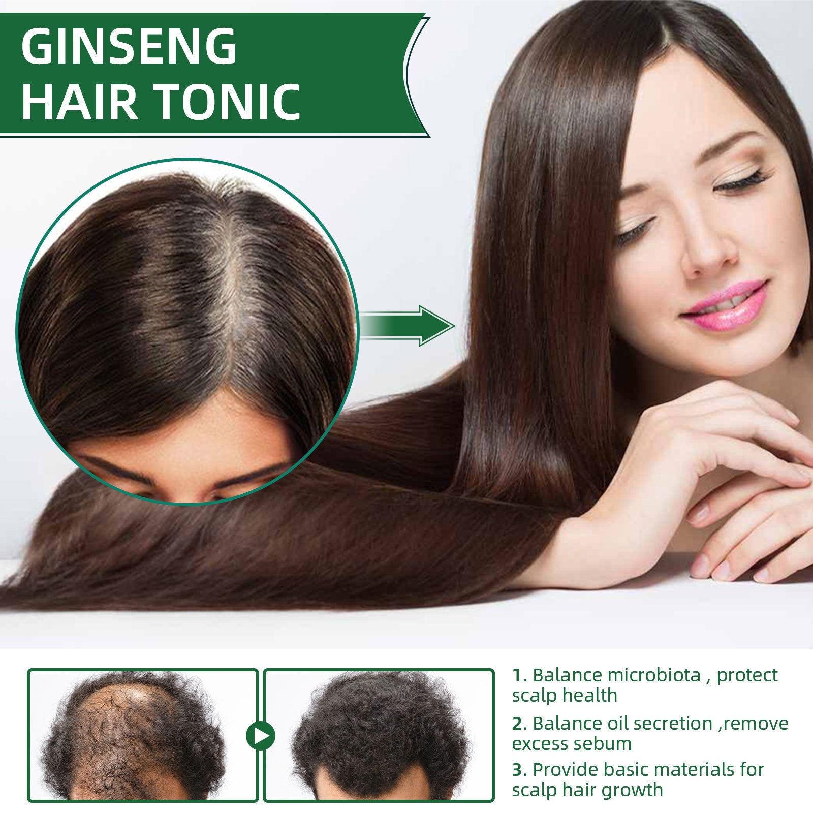 Ouhoe Ginseng Hair Growth Liquid Spray To Prevent Hair Loss