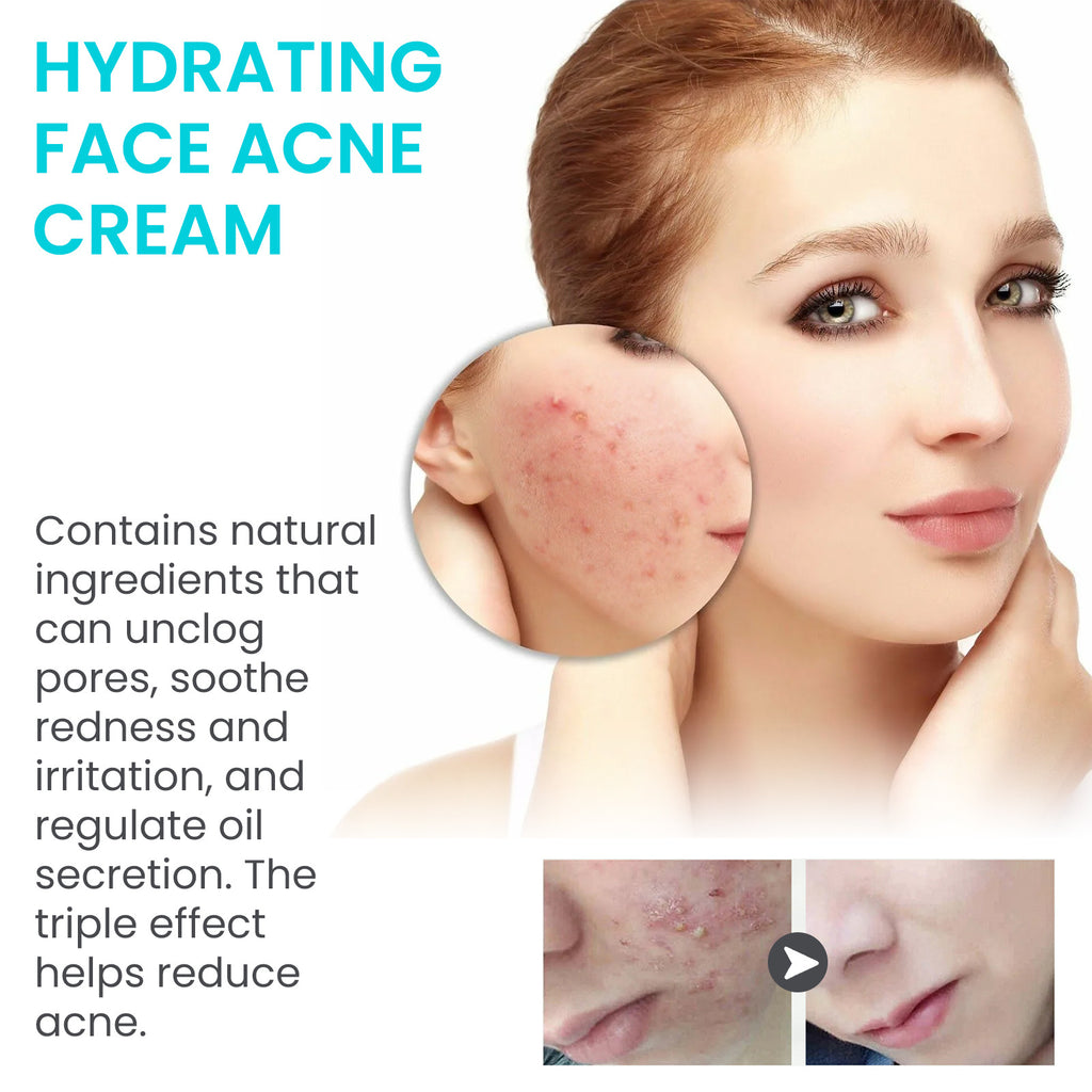 Desalting Pimple Moisturizing Delicate Skin Lightening Cream