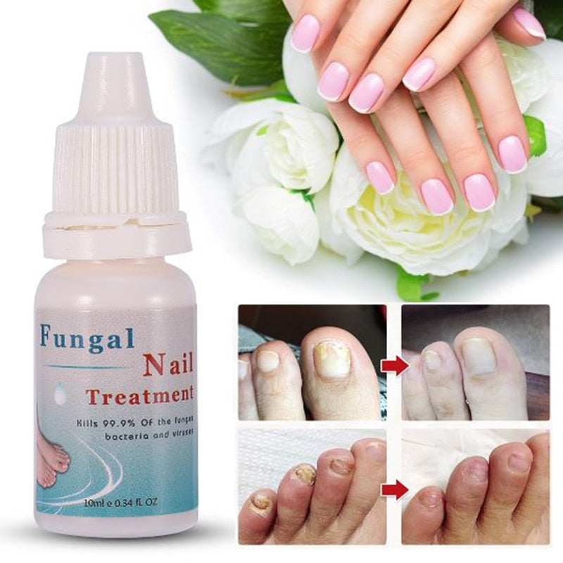 Fungal Moisturizing nail liquid 10ml gray nail repair liquid nourishing armor armor sterilization product