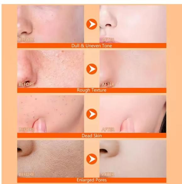 Exfoliating Kojic Acid Turmeric Spray 200 ml Pack of 1