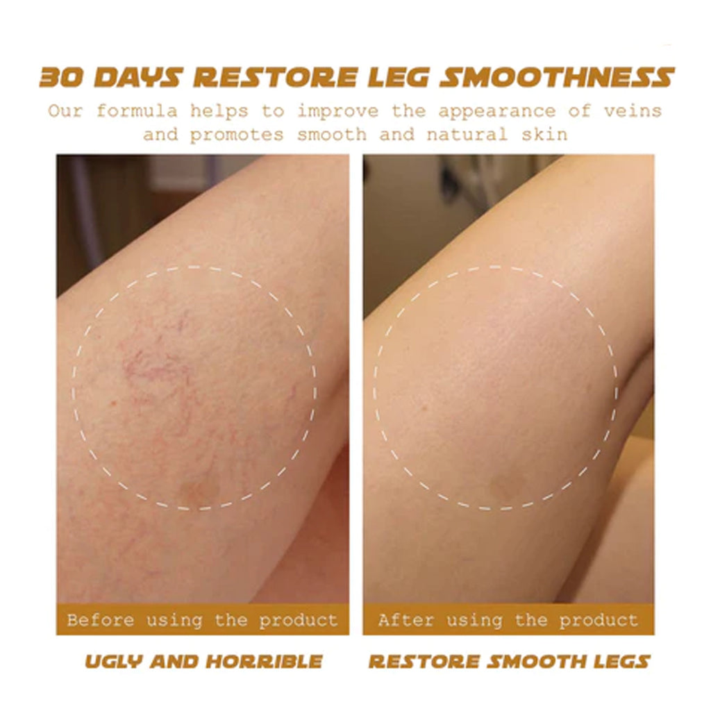 Intravenous Massage Qu Zhang Cream Relieves Soreness
