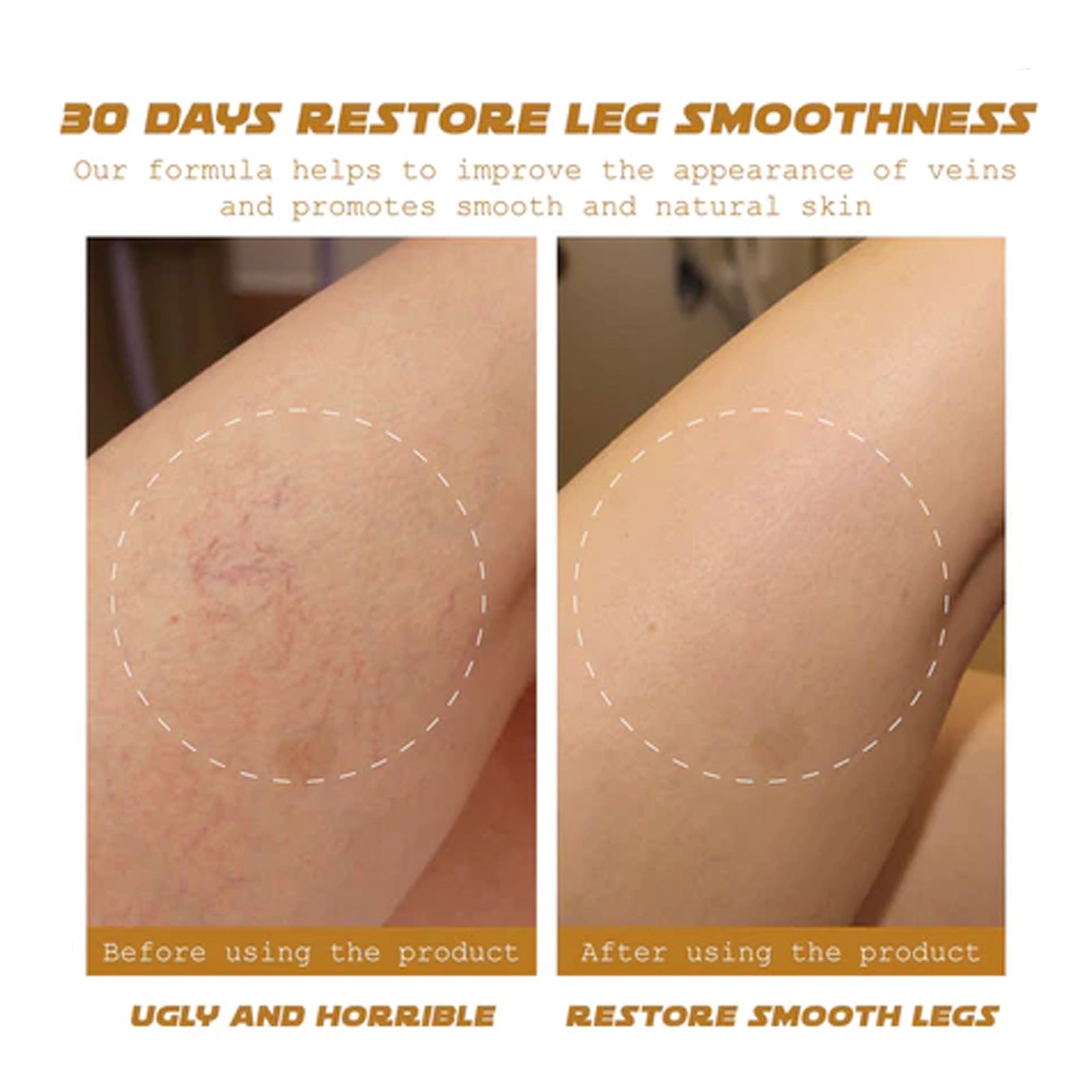 Intravenous Massage Qu Zhang Cream Relieves Soreness