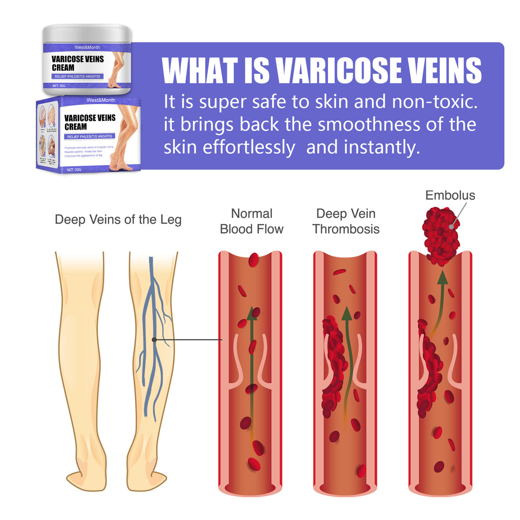 Vein Repair Cream Blue Vein Painful Legs