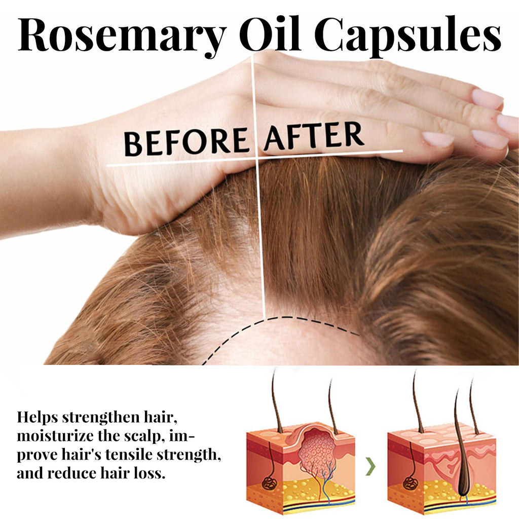 Eelhoe Rosemary Hair Care Capsules Nourish Hair Roots And Prevent Hair Loss